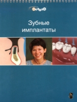 Зубные имплантанты Иллюстрированный перекидной альбом для работы с пациентами артикул 7033d.